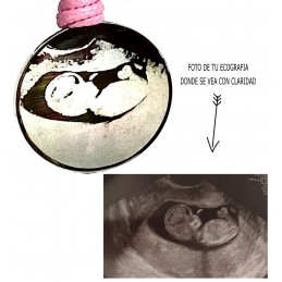 Llavero fotográfia de ultrasonido personalizado, regalo de ecografía embarazada